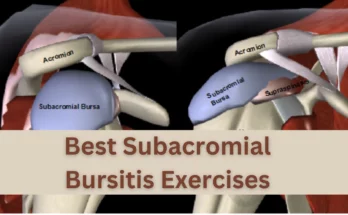 Subacromial Bursitis Exercises