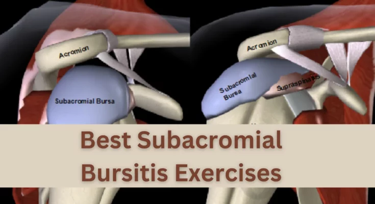Subacromial Bursitis Exercises